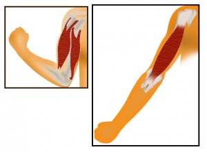 sports massage
